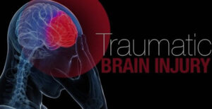 The _Whiplash to Traumatic Brain Injury